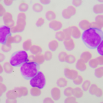 LPK – leukocyter, vita blodkroppar